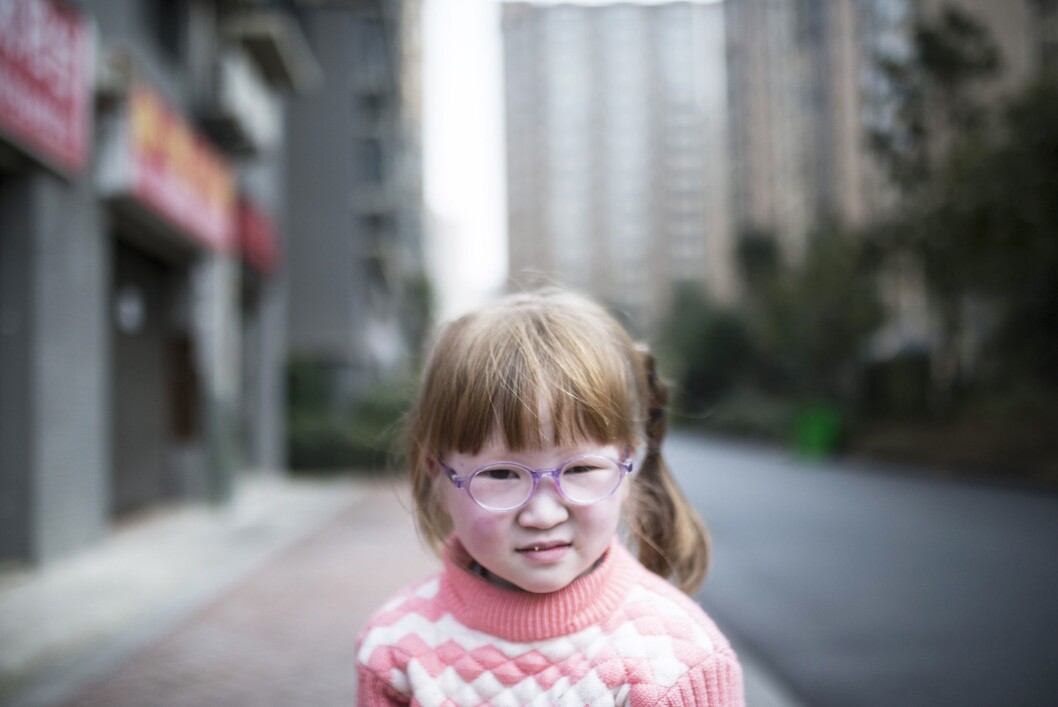 Forventningsfull: Tian Yajies mamma sier: – Jeg ønsker at min datter vokser opp sunn og glad. Jeg vil ikke tillate at andre dømmer henne på grunn av hennes tilstand eller unormale syn. Changsha, Hunan-provinsen. Forventningsfull: Tian Yajies mamma sier: – Jeg ønsker at min datter vokser opp sunn og glad. Jeg vil ikke tillate at andre dømmer henne på grunn av hennes tilstand eller unormale syn. Changsha, Hunan-provinsen.