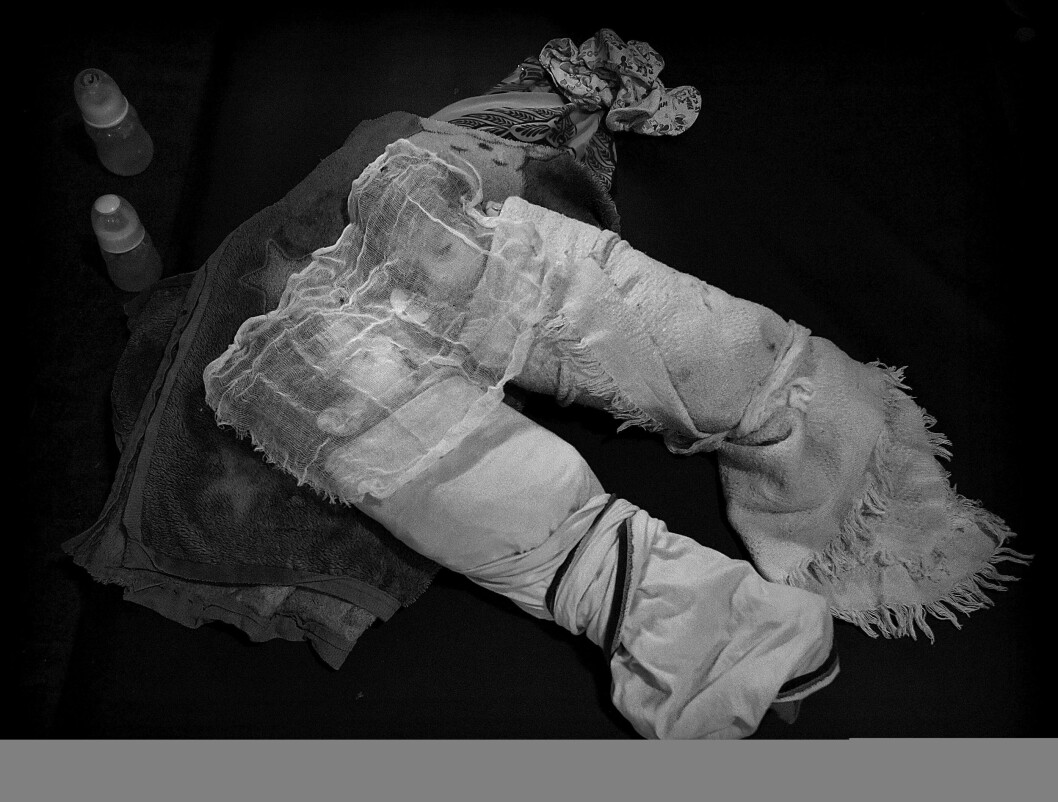 Mariam og Eman er én måned gamle og veier bare 2,24 kilo. Moren M. Awad (31) har ikke nok melk i brystene. Leger uten grenser driver sykehus i Qayyarah, der det blant annet behandles underernærte barn, som har flyktet fra Mosul og andre IS-kontrollerte byer i Irak. Mariam og Eman er én måned gamle og veier bare 2,24 kilo. Moren M. Awad (31) har ikke nok melk i brystene. Leger uten grenser driver sykehus i Qayyarah, der det blant annet behandles underernærte barn, som har flyktet fra Mosul og andre IS-kontrollerte byer i Irak.