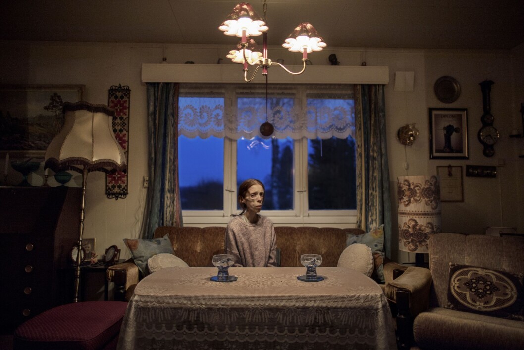 30 år gamle Lene Marie Fossen bor i boligen til bestefaren i Kolbu. Lene Marie lider av ekstrem anoreksi. Hun bruker fotografering som terapi, og har vært åpen om sykdommen. Hennes selvportretter og fotografier av flyktninger har vært stilt ut i blant annet Kristiansund. 30 år gamle Lene Marie Fossen bor i boligen til bestefaren i Kolbu. Lene Marie lider av ekstrem anoreksi. Hun bruker fotografering som terapi, og har vært åpen om sykdommen. Hennes selvportretter og fotografier av flyktninger har vært stilt ut i blant annet Kristiansund.